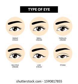Type of eyelid crease vector illustration 