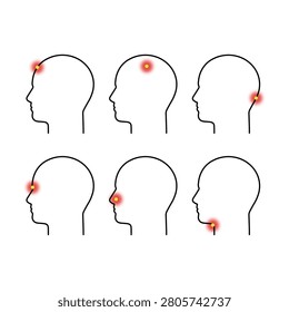 Type of headache and flu fiver, sore throat. Set of head profile with different pains. Side view. Vector