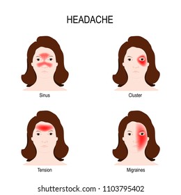 Type Of Headaches: sinus (result from sinus infections), cluster (short episodes of severe pain), tension (band squeezing the head), migraine