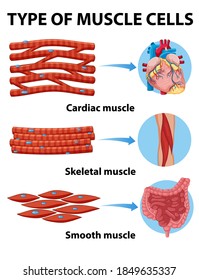 Tipo de ilustración de células musculares