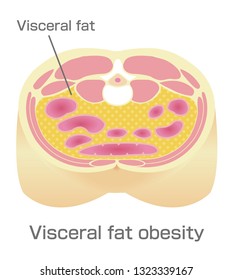 802 Visceral Fat Images, Stock Photos & Vectors | Shutterstock