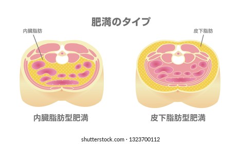 Type of obesity illustration (Japanese). Abdominal sectional View (visceral fat , subcutaneous fat). translation: Type of obesity, Visceral fat (obecity) , Subcutaneous fat (obecity).