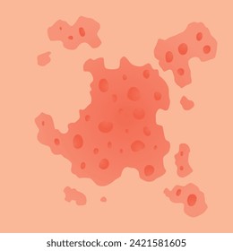 Type of psoriasis vector. Part of patients skin with dermatitis, inflammation, red rash and other skin problems. Cartoon illustration for disease concept