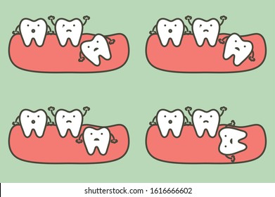 type of wisdom tooth affect to other teeth - dental cartoon vector flat style cute character for design