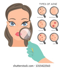 Types of acne appearing on the skin