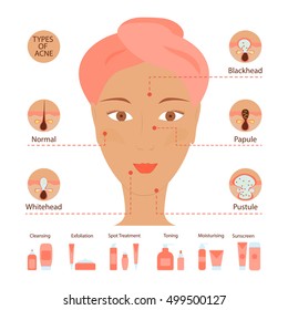 Types of acne pimples human skin poster. Facial treatments infographic. Modern flat design. Sebum in clogged pore, growth bacteria, redness, inflammation. Womens Beauty care. Vector illustration eps10