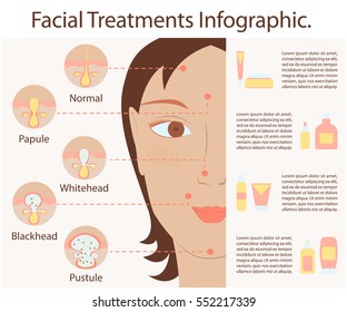 Types of acne pimples human skin poster. Facial treatments infographic. Modern flat design. Sebum in clogged pore, growth bacteria, redness, inflammation. Womens Beauty care. Vector illustration eps10