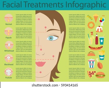 Types of acne pimples human skin poster. Facial treatments infographic. Modern flat design. Sebum in clogged pore, growth bacteria, redness, inflammation. Womens Beauty care. Vector illustration eps10