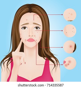 types of acne , skin problems vector illustration