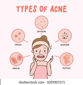 Types Of Acne With Woman Cartoon Illustration Vector On Pink Background. Beauty Concept.