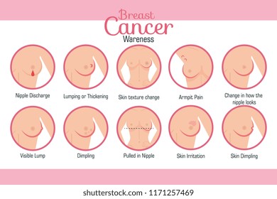 types of appearances of the breast