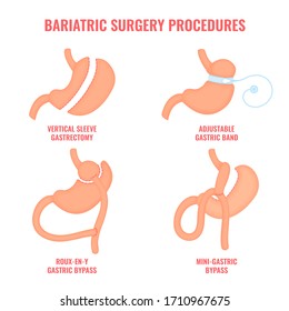 Gastric Stock Vectors, Images & Vector Art | Shutterstock