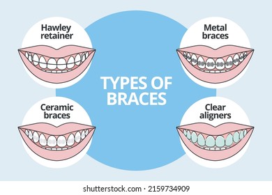 Types Of Braces, orthodontics, vector illustration