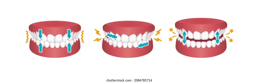 Types of bruxism (teeth grinding) vector illustration