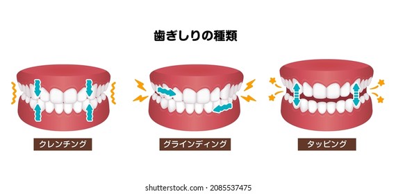 Types of bruxism (teeth grinding) vector illustration. Translation: Types of bruxism, Clenching, Grinding, Tapping