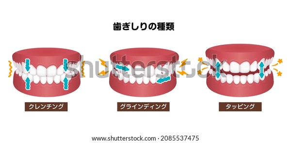 Types of bruxism\
(teeth grinding) vector illustration. Translation: Types of\
bruxism, Clenching, Grinding,\
Tapping
