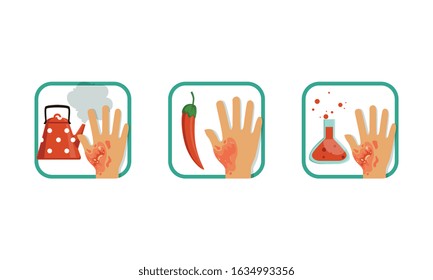 Types of Burns Set, Thermal, Chemical, Hot Chili Pepper Burns, Brochure or Poster Infographic Element Vector Illustration