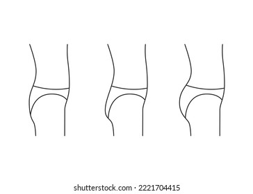 Types of butt woman, shape buttock side, line icon. Augmentation, reshape buttocks from small, flat in full booty. Cosmetic medical procedures, clinic of plastic surgery. Vector outline illustration