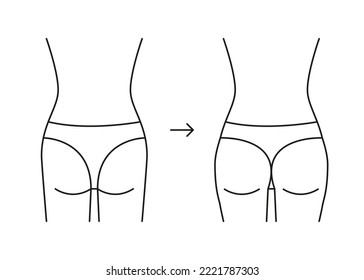 Types of butt woman, shape buttock back, line icon. Augmentation, reshape buttocks from flat in full booty. Cosmetic medical procedures, clinic of plastic surgery. Vector outline illustration