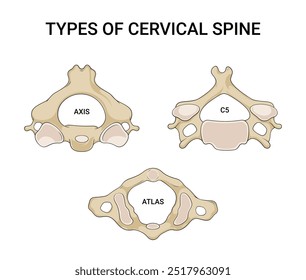 Types of Cervical spine an Overview of Medical Science