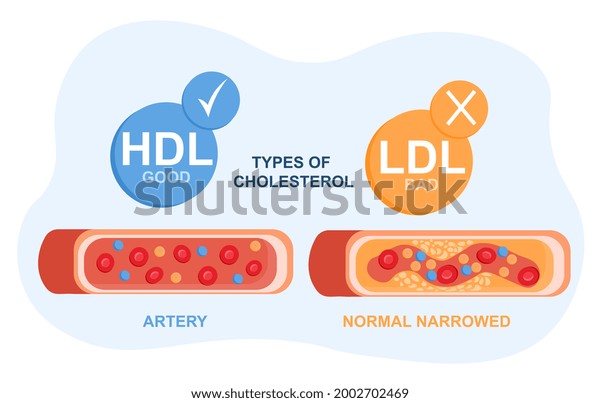 Types of cholesterol in the blood concept.\
High-and low-density lipoproteins. Section of a healthy and narrow\
artery. Prevention of atherosclerosis. Flat vector illustration on\
a white background