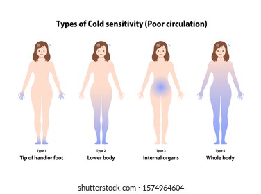 Types Of Cold Sensitivity / Poor Circulation Vector Illustration