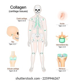 Types Collagen in cartilage tissues. Human skeleton with Costal cartilage. Parts of human body that have collagen: skull, knee, Auricle, Intervertebral disc and Meniscus. vector infographics.