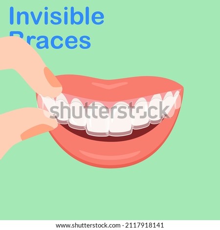 Types of Dental. Smiling white teeth and pink lips. Ceramic, Colors braces. Smile With Braces. wearing orthodontic silicone trainer. Invisible braces aligner. invisalign. removable braces.