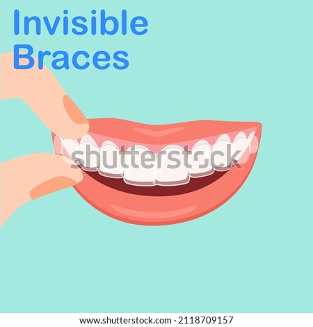 Types of Dental. Smiling white teeth and pink lips. Ceramic, Colors braces. Smile With Braces. wearing orthodontic silicone trainer. Invisible braces aligner. invisalign. removable braces.
