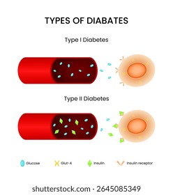 Tipos de Diabetes Guia visual