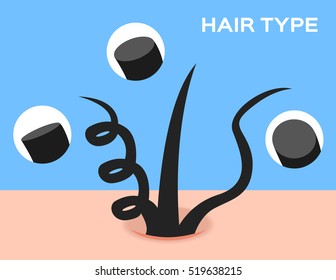 Kinky Hair Disease Images Stock Photos Vectors Shutterstock