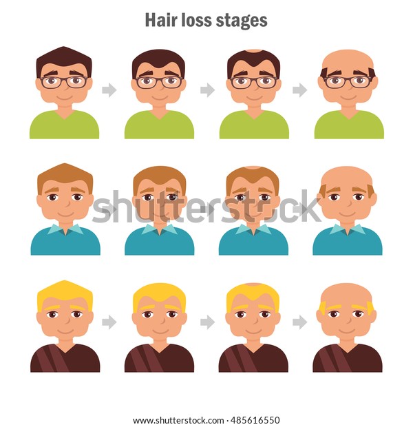 Types Hair Loss Vector Illustration Cartoon Stock Vector Royalty