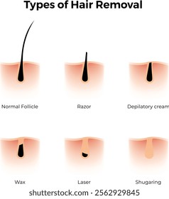 Types of Hair Removal Design Vector Illustration