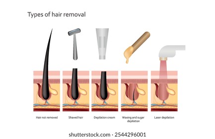 Arten der Haarentfernung, Rasierer, Laser, Wachsen, Laser-Enthaarung. Realistischer Vektor
