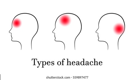 Types of headache, contour medical concept
