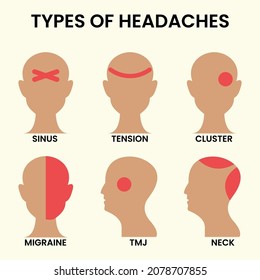 Types of headaches illustration. Vector