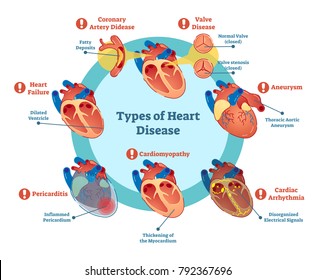 Types of heart disease collection, vector illustration diagram. Educational medical information. 