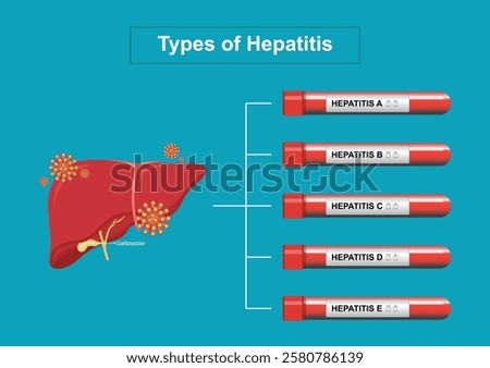Types of hepatitis. Hepatitis is an inflammation of the liver. The most common types of viral hepatitis are: A, B, C, D, and E. , medical health care, vector illustration. 