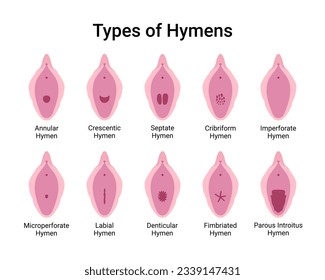 Types of Hymens Medical Vector Illustration