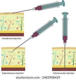 Art der Injektion. Impfung. Aktive Immunisierung.
Intradermale Injektion
 Subkutane Injektion
Intramuskuläre Injektion