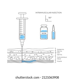 Types of injections. Guide to injecting vaccines into skin. Vector medical procedure manuals for hospital workers
