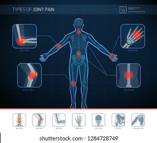 Types Of Joint Pain Medical Infographic With Icons