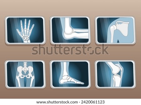 Types of joints. Knee, Elbow, wrist, hip, shoulder joints and Articulations of foot. Set icons. X-ray image. Isometric Flat vector illustration.