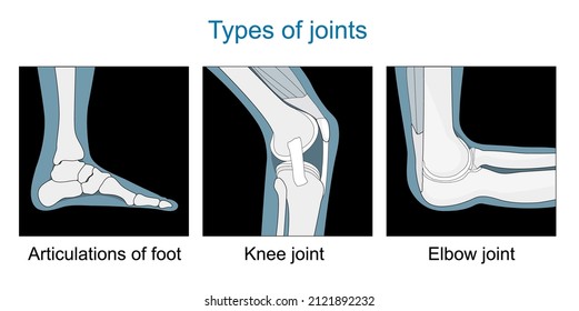 Types of joints. Knee joint, Articulations of foot, Elbow joint. Set icons. black and white. Flat vector illustration.