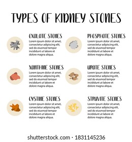 Types Of Kidneys Stones. Oxalate, Phosphate, Xanthine, Urate, Cystine, Struvite Stones. Urolithiasis Disease. Urinary System, Kidney And Bladder Disease. Vector Flat Illustration