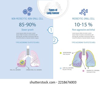 Types of lung cancer, non-small cell and small cell. Area of the lung that is affected according to the typ