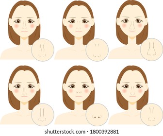 types of nose. vector illustration