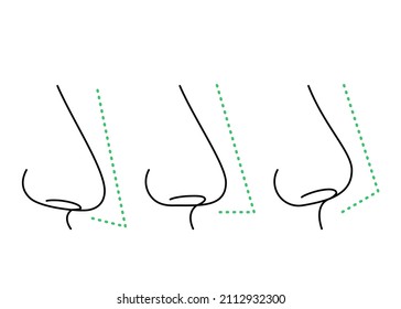 retrousse nose profile clipart