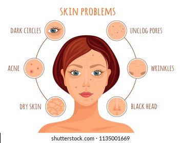 Types of skin problems. Vector illustration. Information banner on the skin care. A woman's face with examples of skin problems.