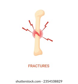  Types of spiral fractures in human